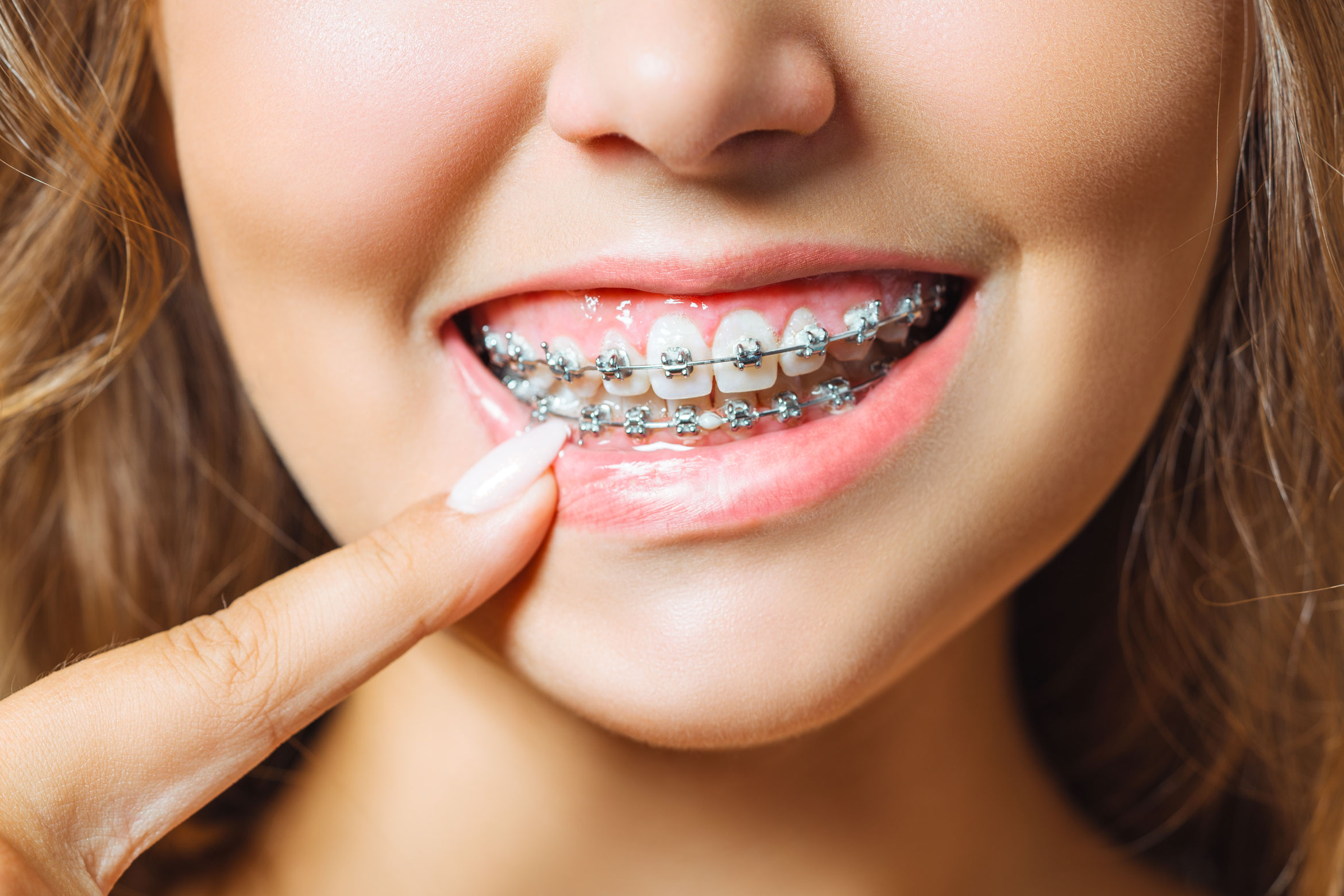 Estetica Dentale e Ortodonzia